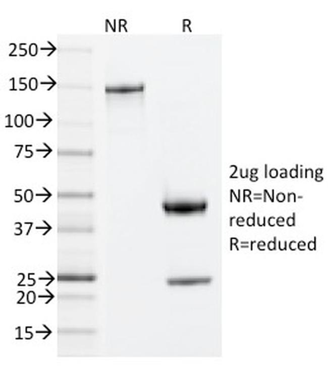 ZAP70 Antibody in SDS-PAGE (SDS-PAGE)
