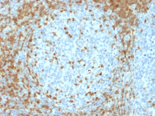 ZAP70 Antibody in Immunohistochemistry (Paraffin) (IHC (P))