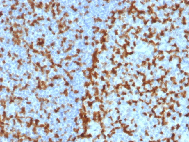 ZAP70 (Chronic Lymphocytic Leukemia Marker) Antibody in Immunohistochemistry (Paraffin) (IHC (P))