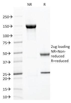 ZAP70 (Chronic Lymphocytic Leukemia Marker) Antibody in SDS-PAGE (SDS-PAGE)