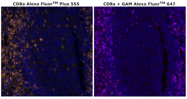 CD8 alpha Antibody in Immunohistochemistry (Paraffin) (IHC (P))