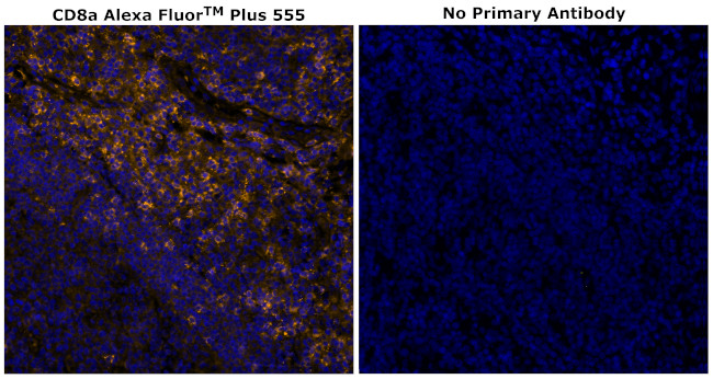 CD8 alpha Antibody in Immunohistochemistry (Paraffin) (IHC (P))