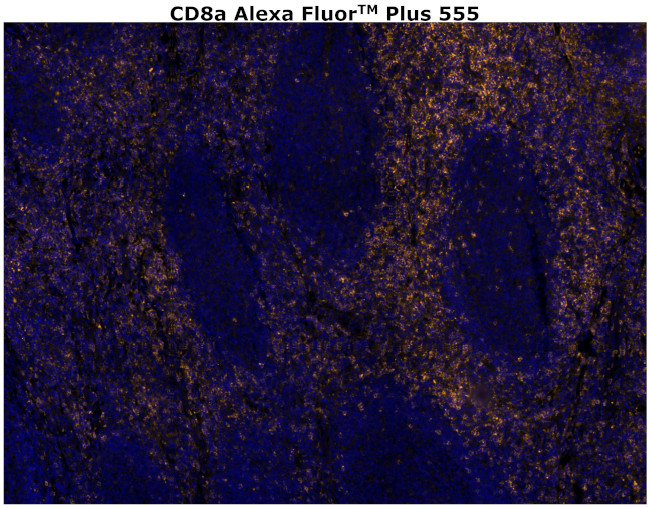 CD8 alpha Antibody in Immunohistochemistry (Paraffin) (IHC (P))