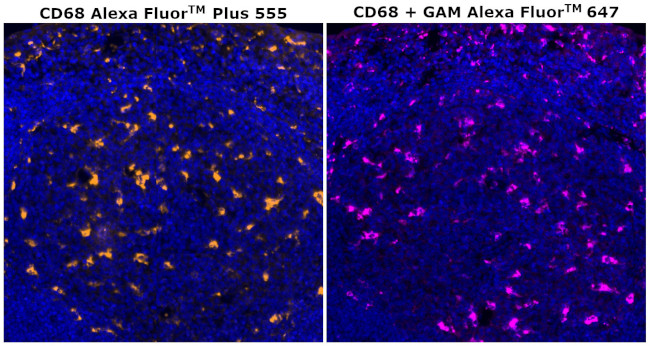 CD68 Antibody in Immunohistochemistry (Paraffin) (IHC (P))