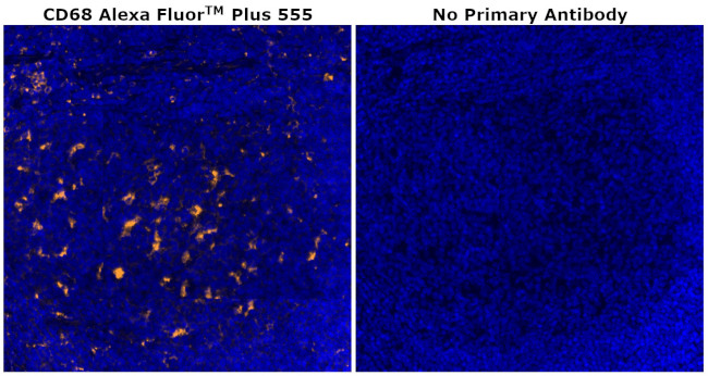 CD68 Antibody in Immunohistochemistry (Paraffin) (IHC (P))