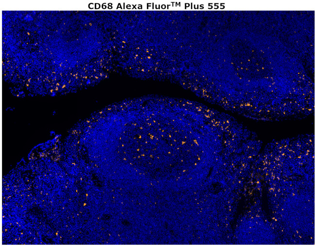 CD68 Antibody in Immunohistochemistry (Paraffin) (IHC (P))