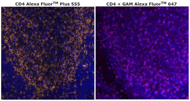 CD4 Antibody in Immunohistochemistry (Paraffin) (IHC (P))