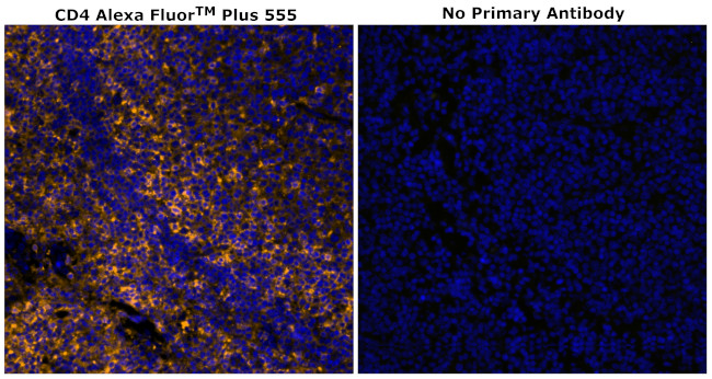 CD4 Antibody in Immunohistochemistry (Paraffin) (IHC (P))