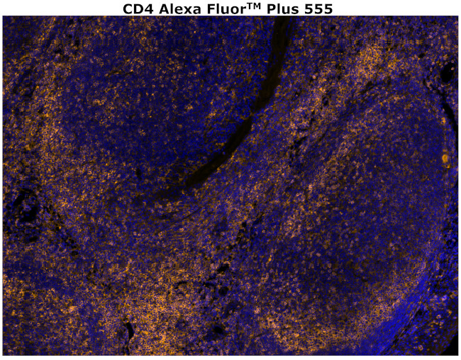 CD4 Antibody in Immunohistochemistry (Paraffin) (IHC (P))