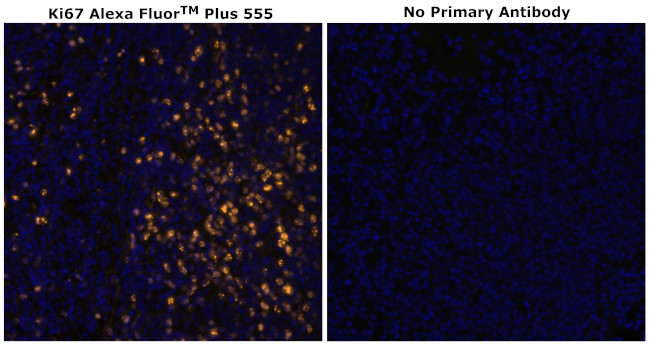 Ki-67 Antibody in Immunohistochemistry (Paraffin) (IHC (P))