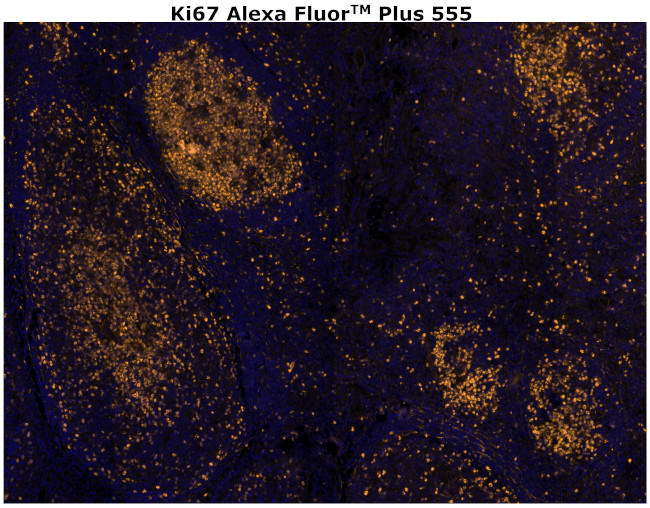 Ki-67 Antibody in Immunohistochemistry (Paraffin) (IHC (P))