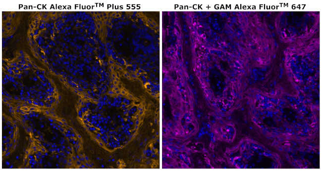 Cytokeratin Pan Type I/II Antibody in Immunohistochemistry (Paraffin) (IHC (P))