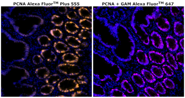 PCNA Antibody in Immunohistochemistry (Paraffin) (IHC (P))