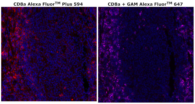 CD8 alpha Antibody in Immunohistochemistry (Paraffin) (IHC (P))