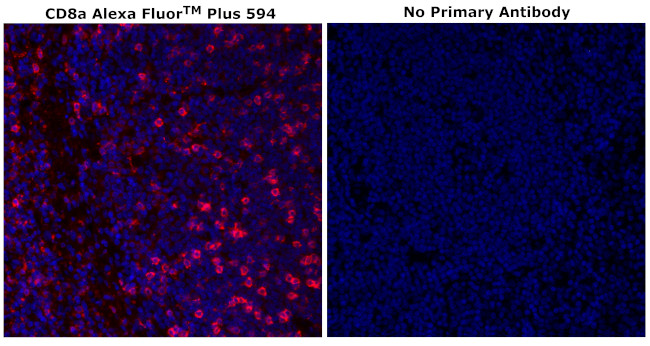 CD8 alpha Antibody in Immunohistochemistry (Paraffin) (IHC (P))