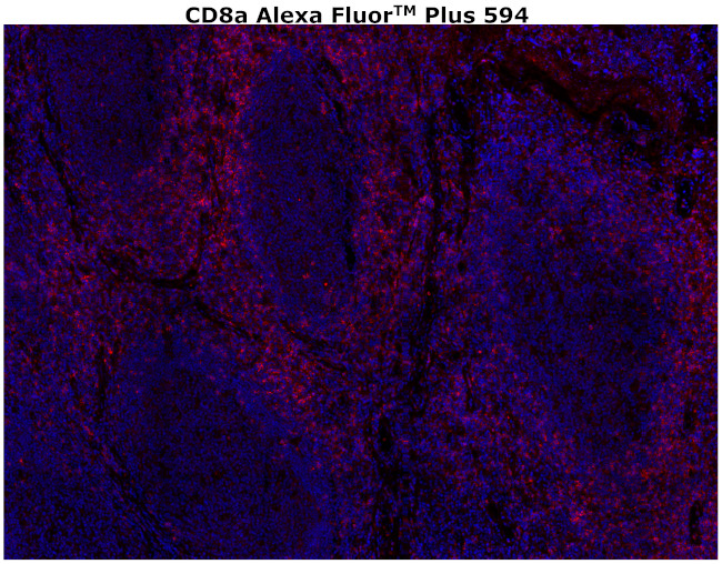 CD8 alpha Antibody in Immunohistochemistry (Paraffin) (IHC (P))