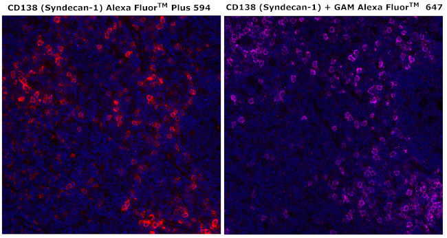 CD138 Antibody in Immunohistochemistry (Paraffin) (IHC (P))