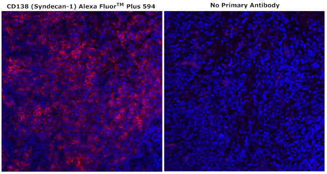 CD138 Antibody in Immunohistochemistry (Paraffin) (IHC (P))