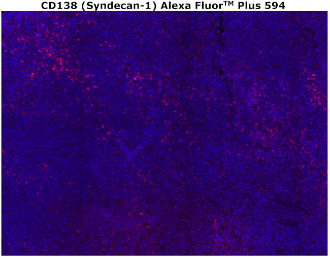 CD138 Antibody in Immunohistochemistry (Paraffin) (IHC (P))