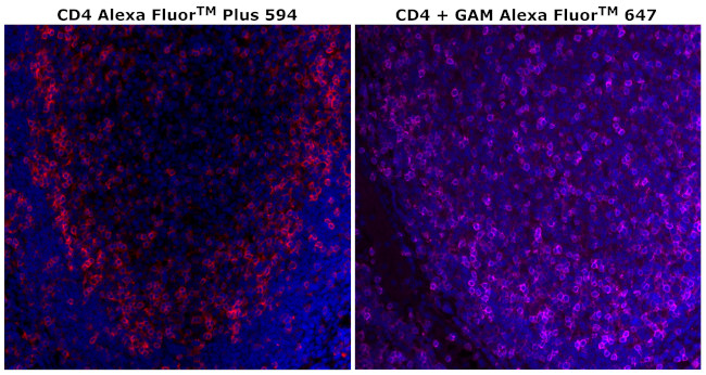 CD4 Antibody in Immunohistochemistry (Paraffin) (IHC (P))