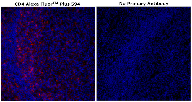 CD4 Antibody in Immunohistochemistry (Paraffin) (IHC (P))