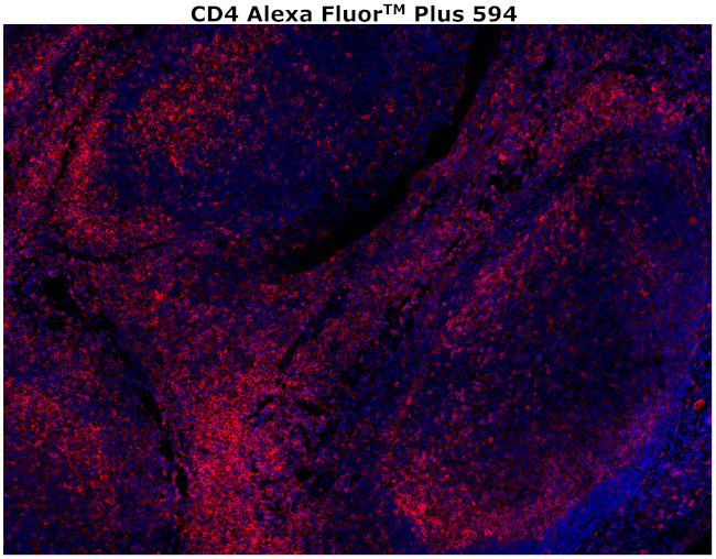 CD4 Antibody in Immunohistochemistry (Paraffin) (IHC (P))