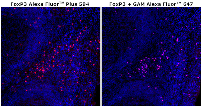 FOXP3 Antibody in Immunohistochemistry (Paraffin) (IHC (P))