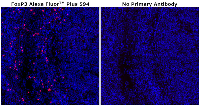 FOXP3 Antibody in Immunohistochemistry (Paraffin) (IHC (P))