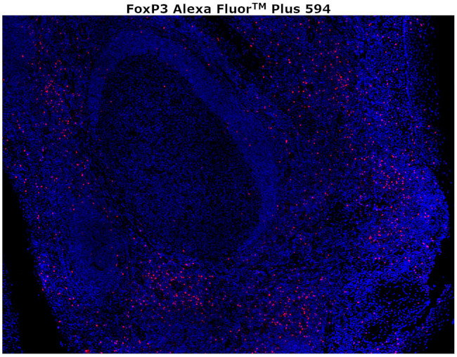 FOXP3 Antibody in Immunohistochemistry (Paraffin) (IHC (P))