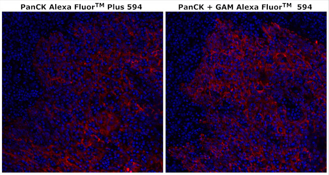 Cytokeratin Pan Type I/II Antibody in Immunohistochemistry (Paraffin) (IHC (P))