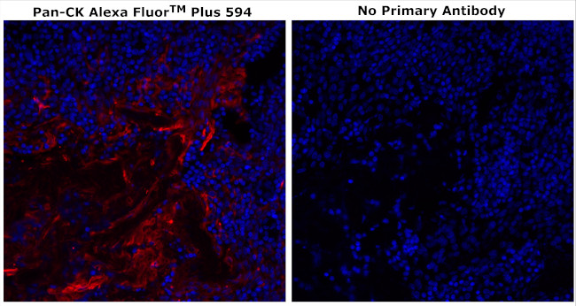 Cytokeratin Pan Type I/II Antibody in Immunohistochemistry (Paraffin) (IHC (P))