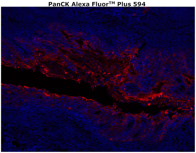 Cytokeratin Pan Type I/II Antibody in Immunohistochemistry (Paraffin) (IHC (P))