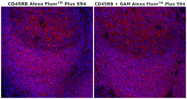 CD45RB Antibody in Immunohistochemistry (Paraffin) (IHC (P))