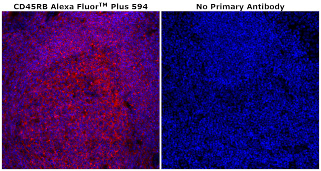 CD45RB Antibody in Immunohistochemistry (Paraffin) (IHC (P))