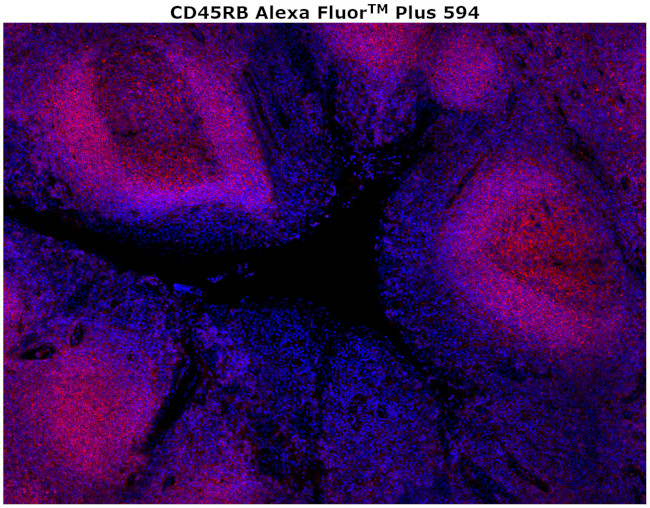 CD45RB Antibody in Immunohistochemistry (Paraffin) (IHC (P))