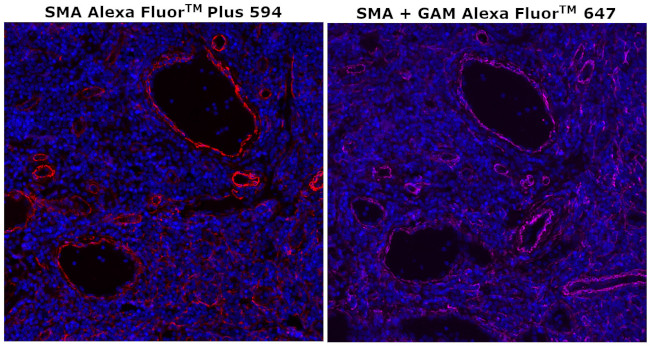 Alpha-Smooth Muscle Actin Antibody in Immunohistochemistry (Paraffin) (IHC (P))