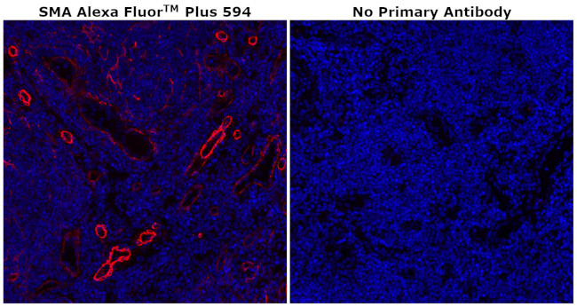 Alpha-Smooth Muscle Actin Antibody in Immunohistochemistry (Paraffin) (IHC (P))