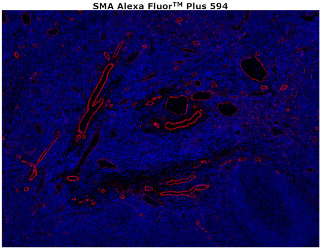 Alpha-Smooth Muscle Actin Antibody in Immunohistochemistry (Paraffin) (IHC (P))