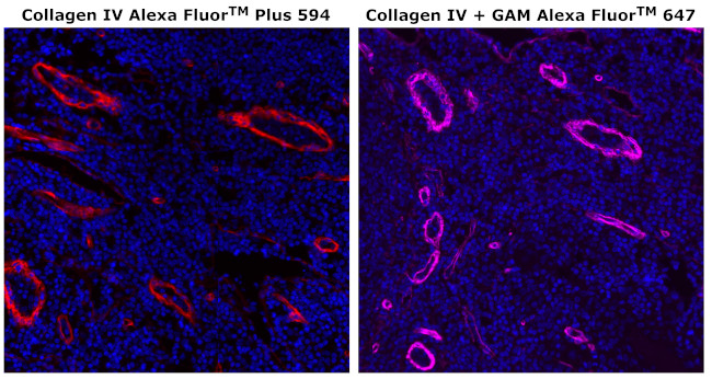 Collagen IV Antibody in Immunohistochemistry (Paraffin) (IHC (P))