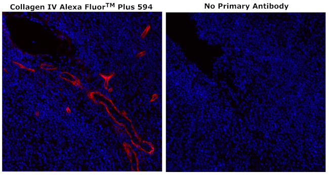 Collagen IV Antibody in Immunohistochemistry (Paraffin) (IHC (P))