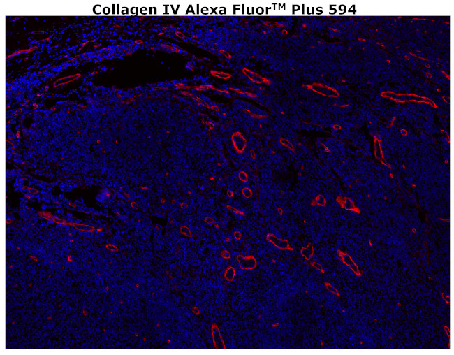 Collagen IV Antibody in Immunohistochemistry (Paraffin) (IHC (P))