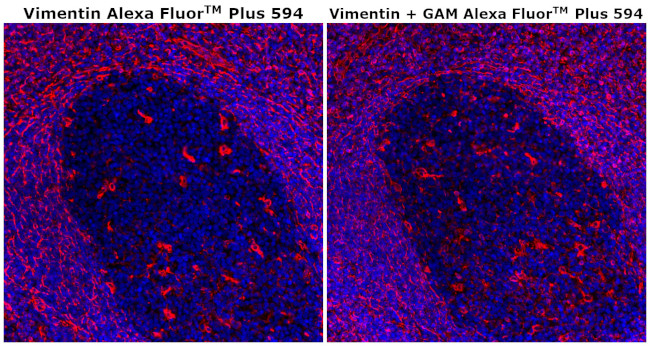 Vimentin Antibody in Immunohistochemistry (Paraffin) (IHC (P))