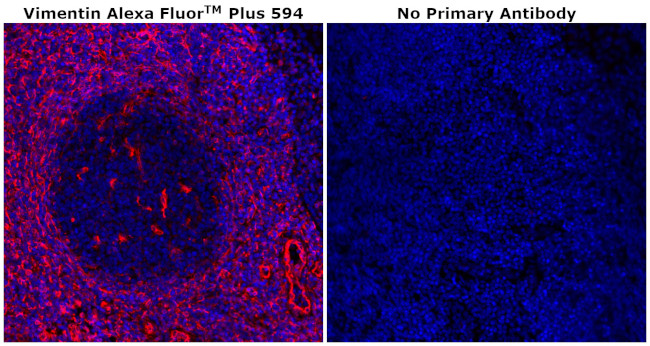 Vimentin Antibody in Immunohistochemistry (Paraffin) (IHC (P))