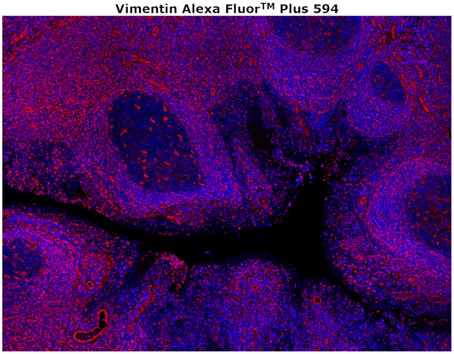 Vimentin Antibody in Immunohistochemistry (Paraffin) (IHC (P))