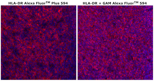 HLA-DR Antibody in Immunohistochemistry (Paraffin) (IHC (P))