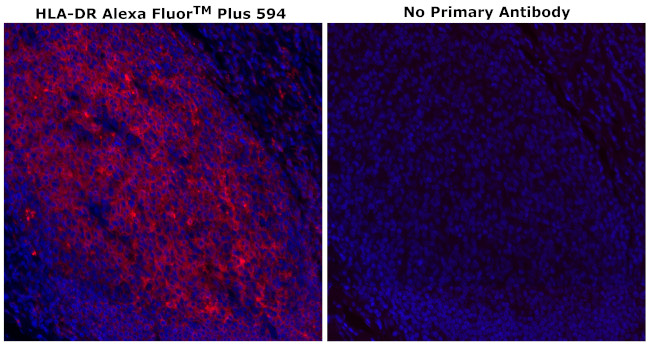 HLA-DR Antibody in Immunohistochemistry (Paraffin) (IHC (P))