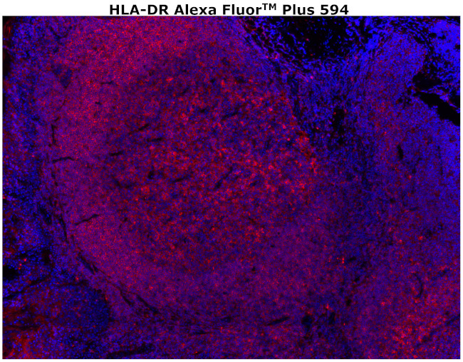 HLA-DR Antibody in Immunohistochemistry (Paraffin) (IHC (P))