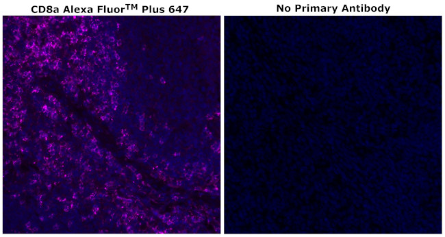 CD8 alpha Antibody in Immunohistochemistry (Paraffin) (IHC (P))