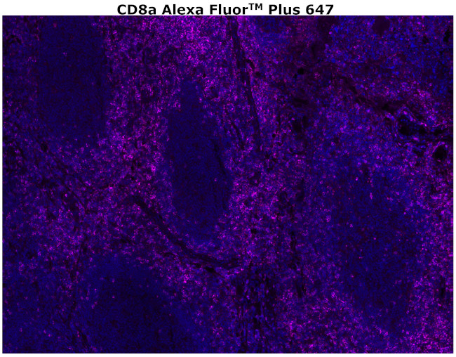 CD8 alpha Antibody in Immunohistochemistry (Paraffin) (IHC (P))