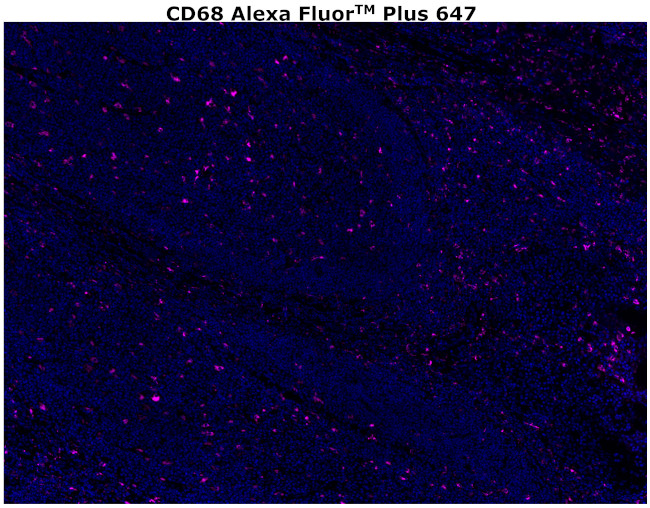 CD68 Antibody in Immunohistochemistry (Paraffin) (IHC (P))